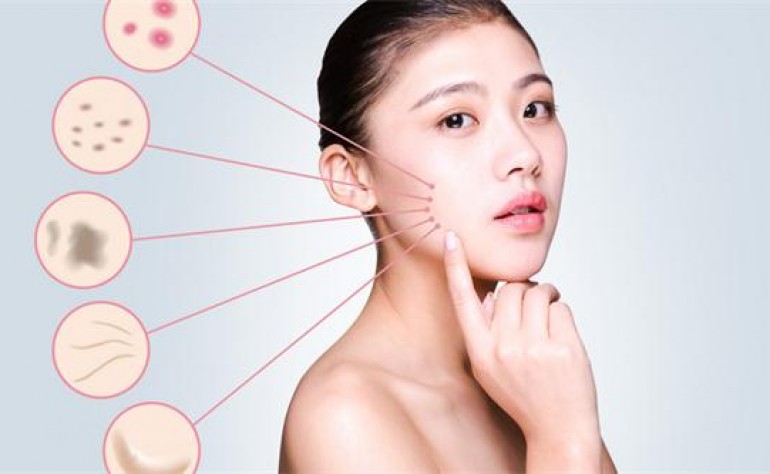 右臉長痘痘是如何產生的，去痘痘最好的方法！獨生美告訴你祛痘美容護膚小常識！