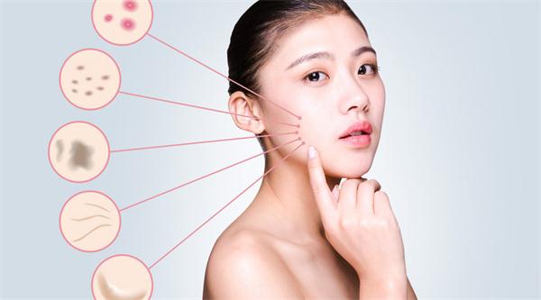 右臉長痘痘是如何產生的，去痘痘最好的方法！獨生美告訴你祛痘美容護膚小常識！