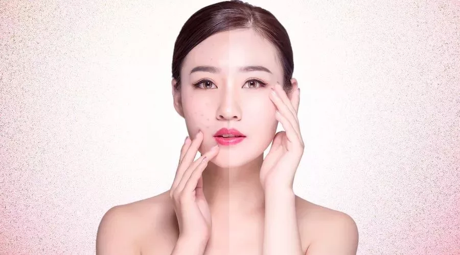 美白祛斑最有效的方法？口碑最好的祛斑護膚品？美容護膚獨生美官網！
