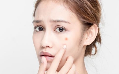 粉刺不擠自己會消除嗎？粉刺痘痘怎么消除？美容護膚獨生美官網