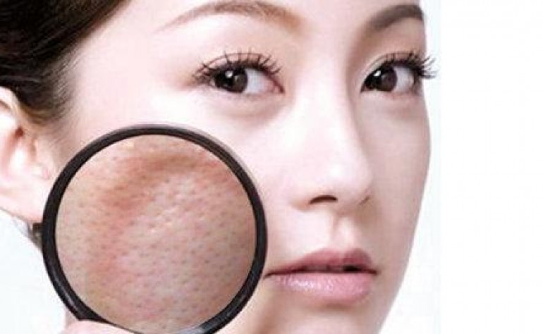 皮膚毛孔粗大怎么辦？獨生美教你幾招避免毛孔粗大及解決毛孔粗大的美容護膚小竅門！