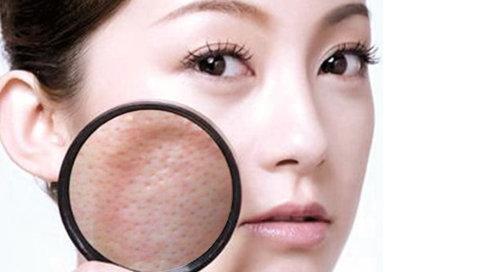 皮膚毛孔粗大怎么辦？獨生美教你幾招避免毛孔粗大及解決毛孔粗大的美容護膚小竅門！
