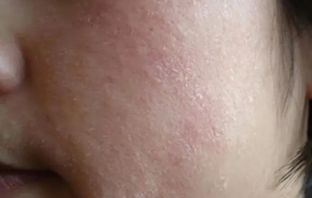 【獨生美】618好物就在視頻號 皮膚換季敏感拯救夏季干皮 懶人專用護膚品